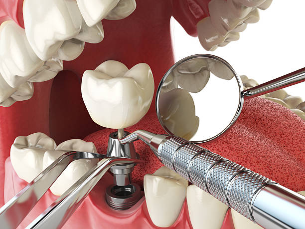 Emergency Gum Pain Relief in TN
