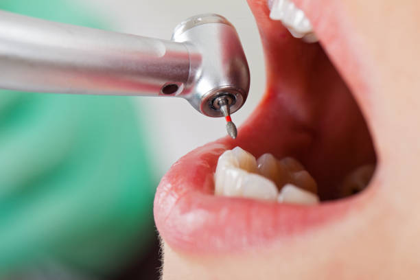 Best Dentist for Tooth Abscess  in Murfreesboro, TN
